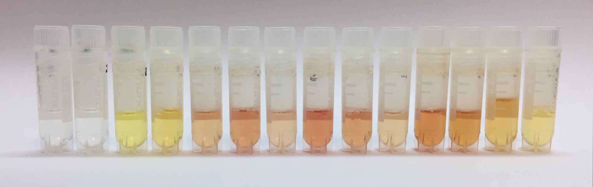 Temporal course of cerebrospinal fluid sampling across the early phase after aneurysmal subarachnoid haemorrhage
